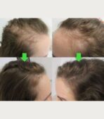 Ser Biotin - imagine 2